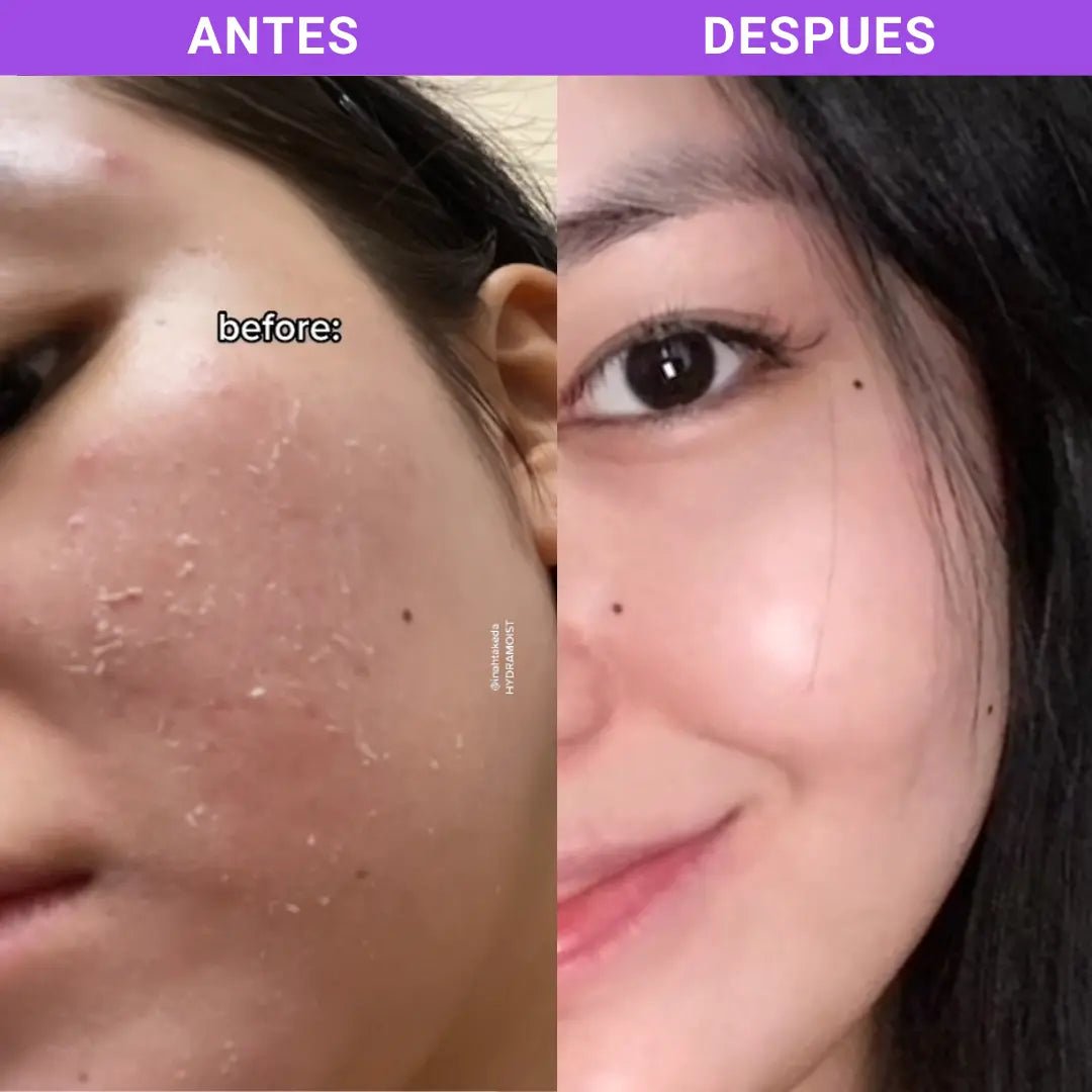 Kit x3 Anti - Resequedad - Everlace